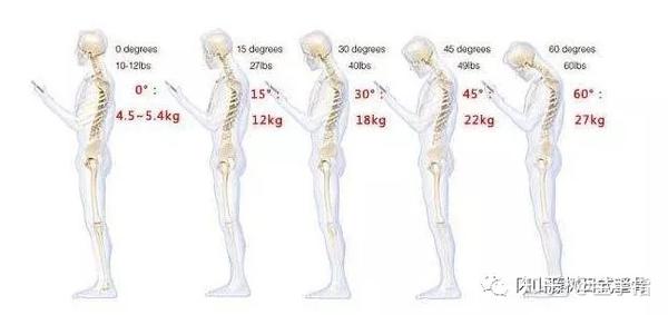 脊柱姿势不良，深入了解与正确应对，应该挂什么科？