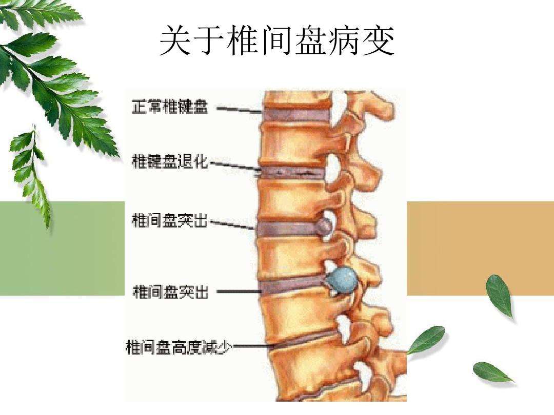 预防脊柱异常弯曲的教学反思，探索有效方法与策略