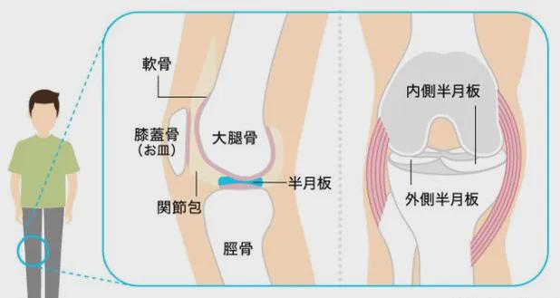 探讨，最佳医院选择——半月板损伤诊疗权威机构