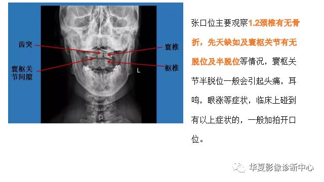 脊柱操作视频，直观高效的学习途径