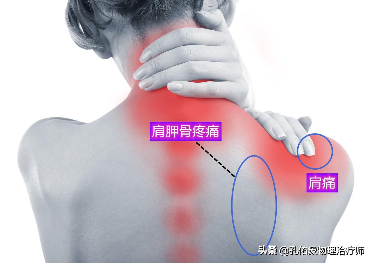 肩胛骨位置疼痛对照表及其实际应用指南