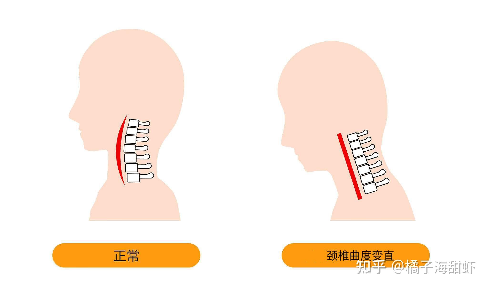 曲度的奥秘，应用与效果探究