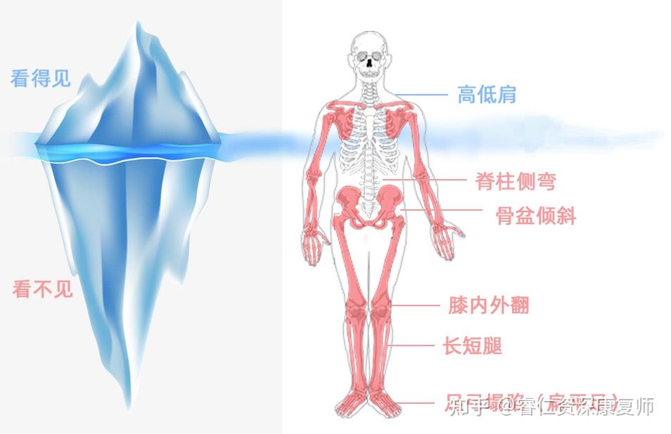 脊柱健康状况评估，全面解读你的脊柱测试报告