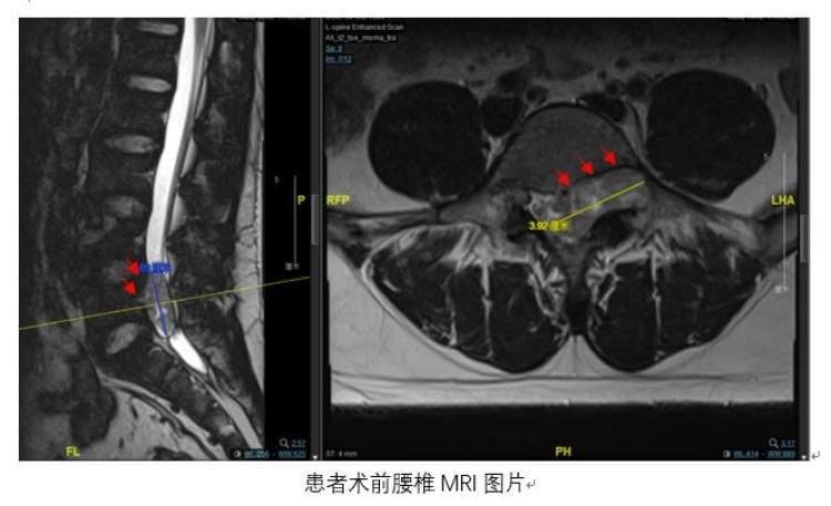 脊柱健康管理 第191页