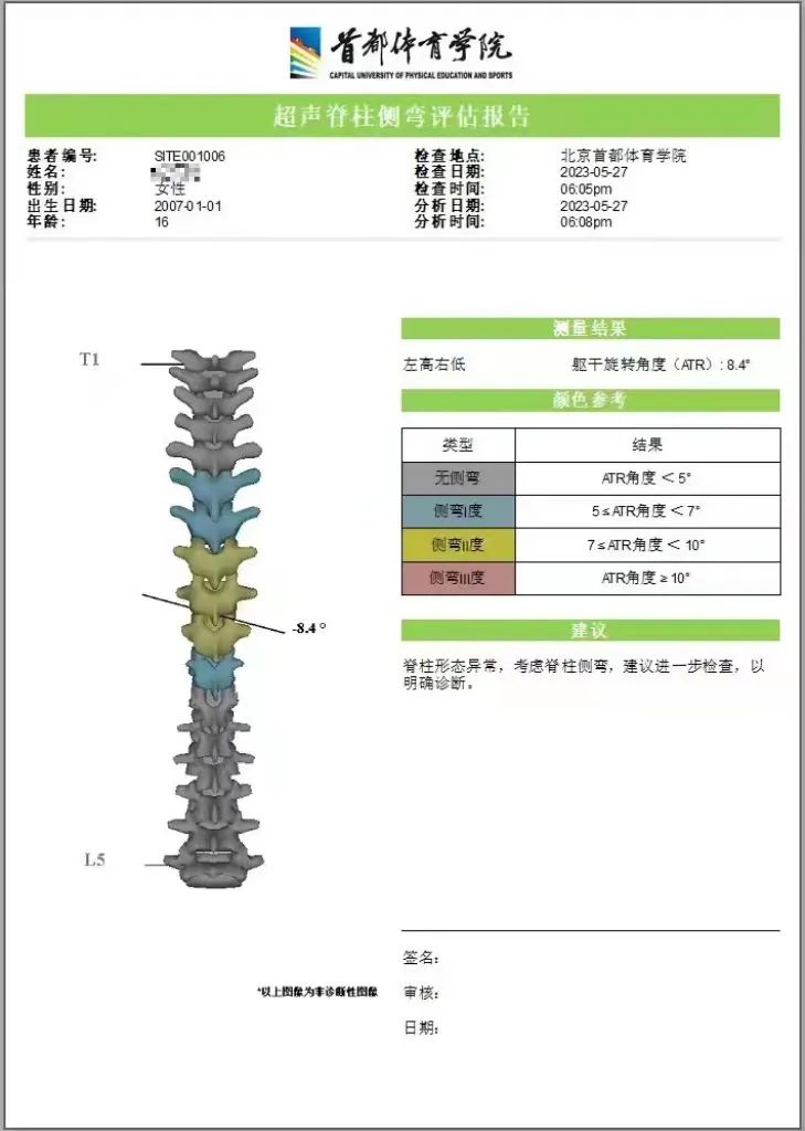 脊柱健康体检报告，评估结果及指导建议