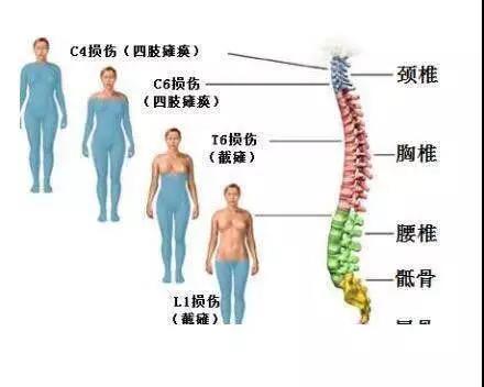 脊柱损伤恢复最佳方法