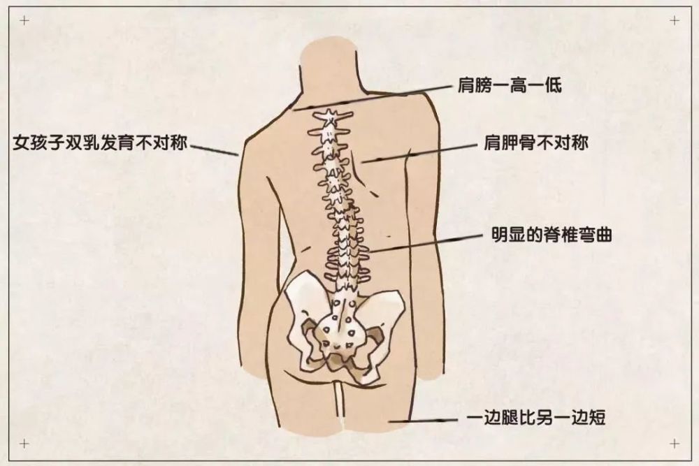 脊柱生理弯曲，深度解析与保护策略