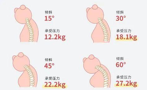 现代生活下的脊柱压力优势及保护策略