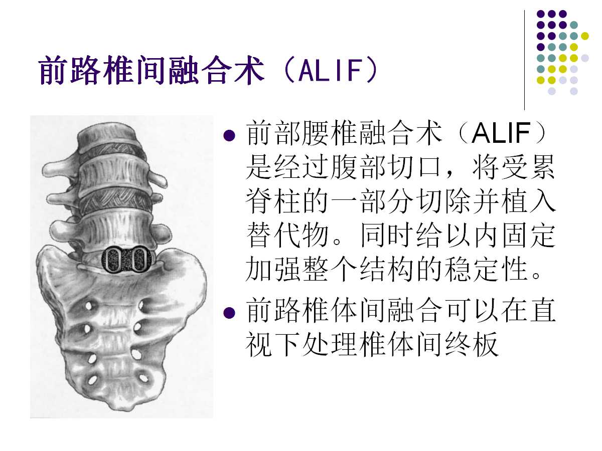 腰椎融合术，现代腰椎疾病治疗核心技术解析