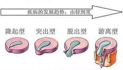 人体脊柱的构成与奥秘探索