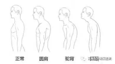 最常见脊椎病类型及其特性概述