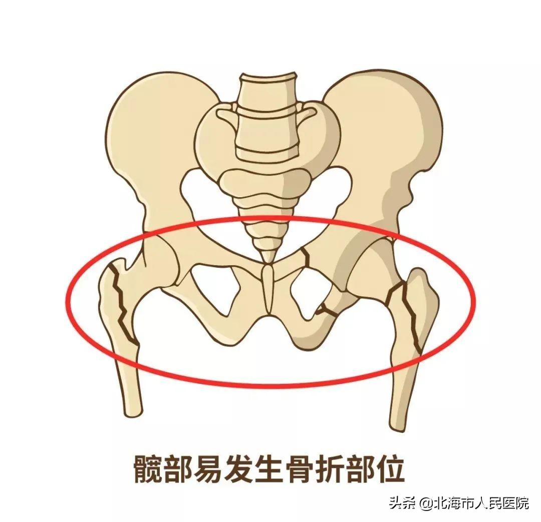 老年脊柱护理操作流程详解图解