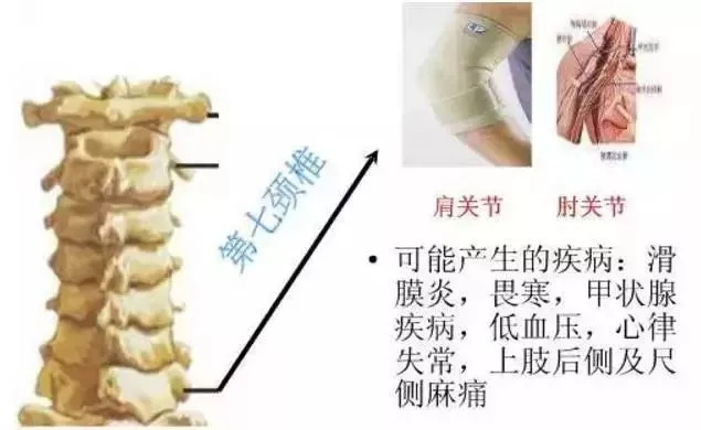 脊柱疾病百科，108种疾病图片详解与识别