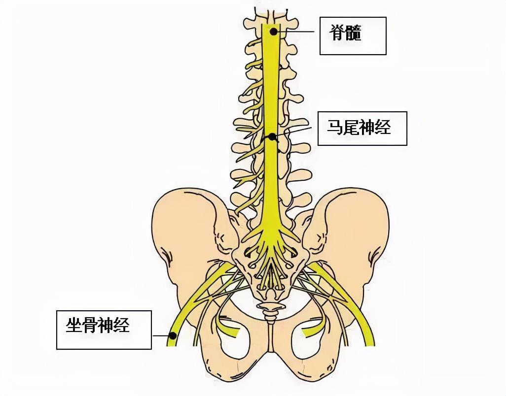 腰椎间盘突出手术成功率及相关因素解析