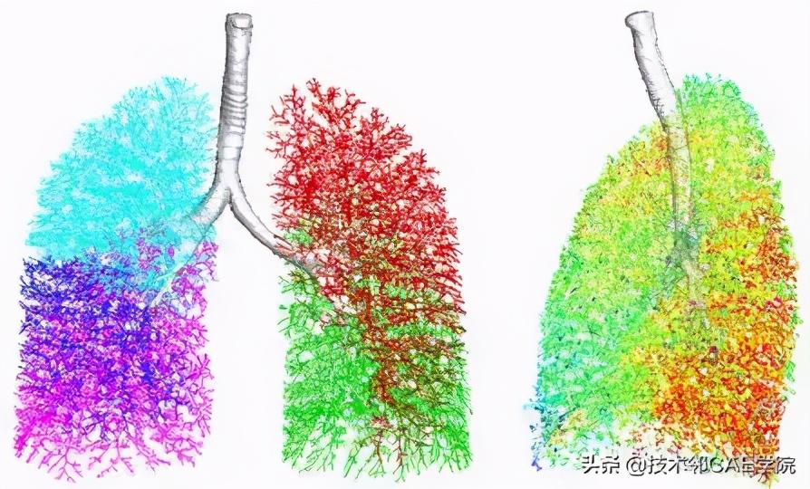 物理治疗设备，种类、功能及应用领域概述