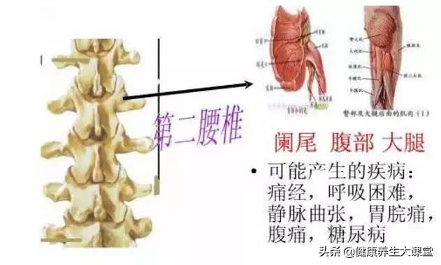 脊柱疾病详解，涵盖108种相关问题解析