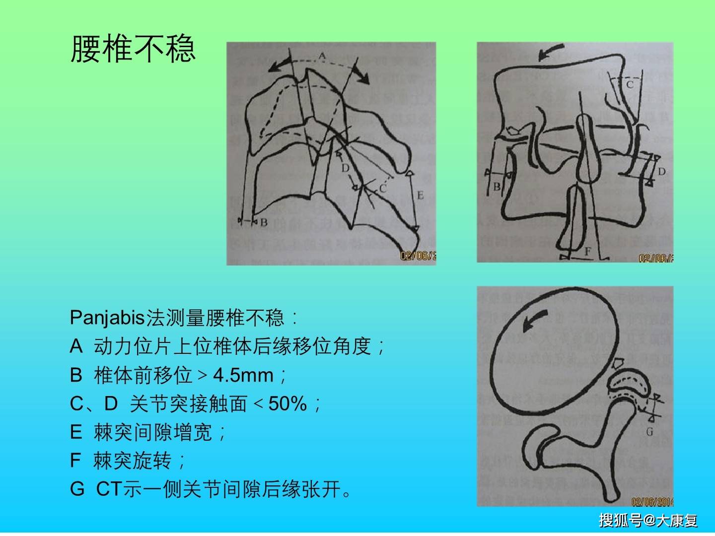 脊柱检查的临床意义与重要性