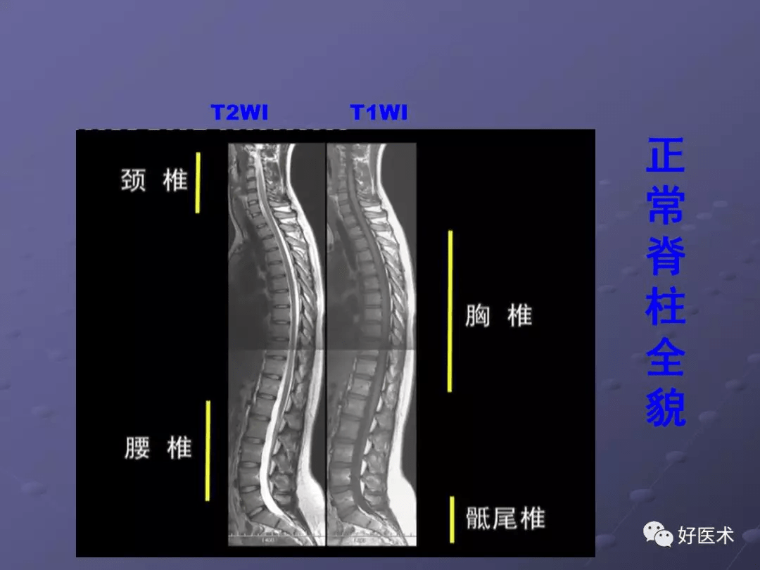 深入理解人体支柱结构，脊柱讲解视频