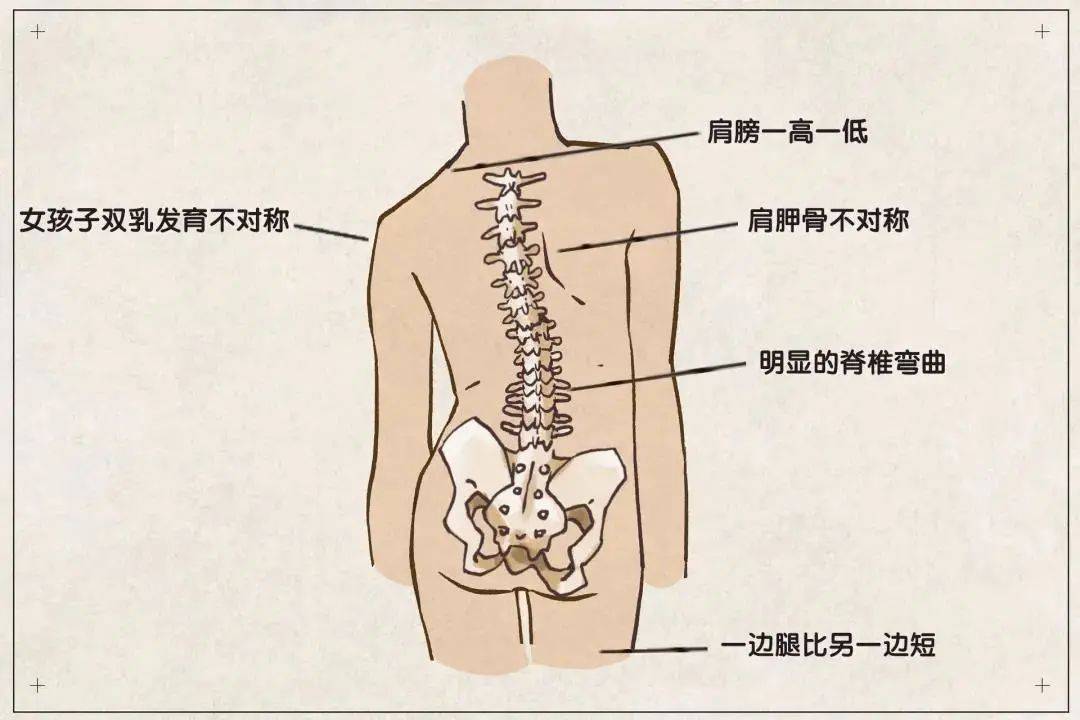 脊柱姿势，健康与平衡的关键塑造因素